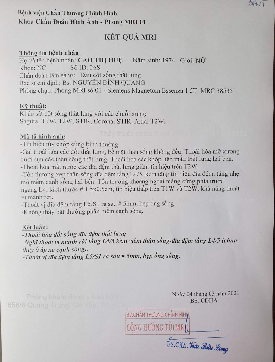 Thoát vị đĩa đệm 